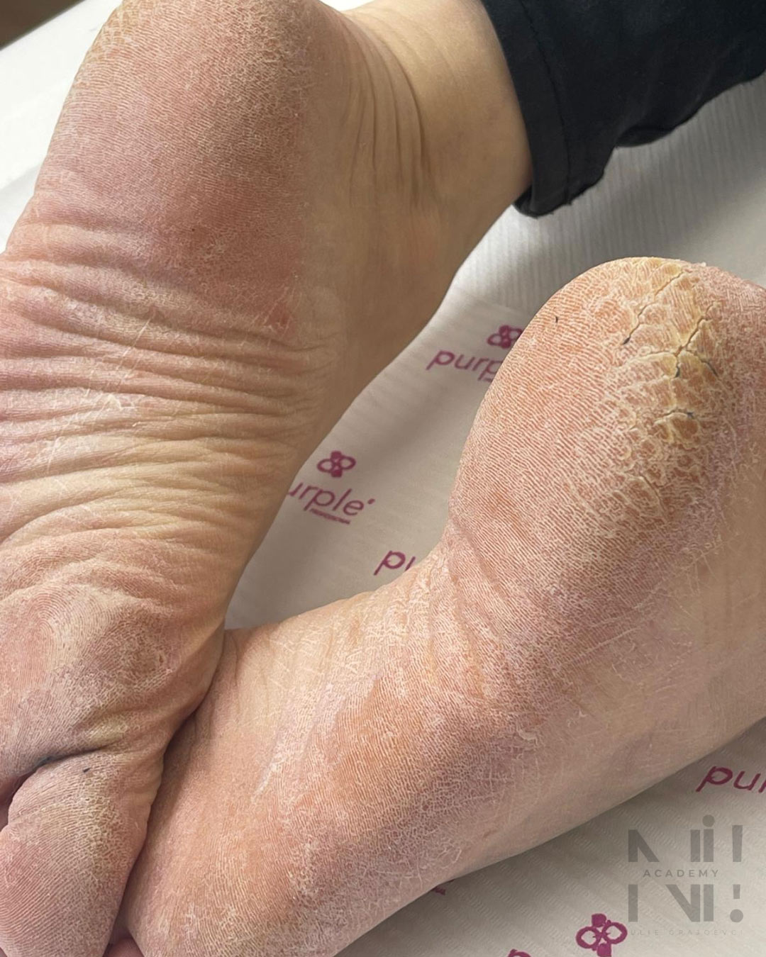 soin des pieds fraise nail shop